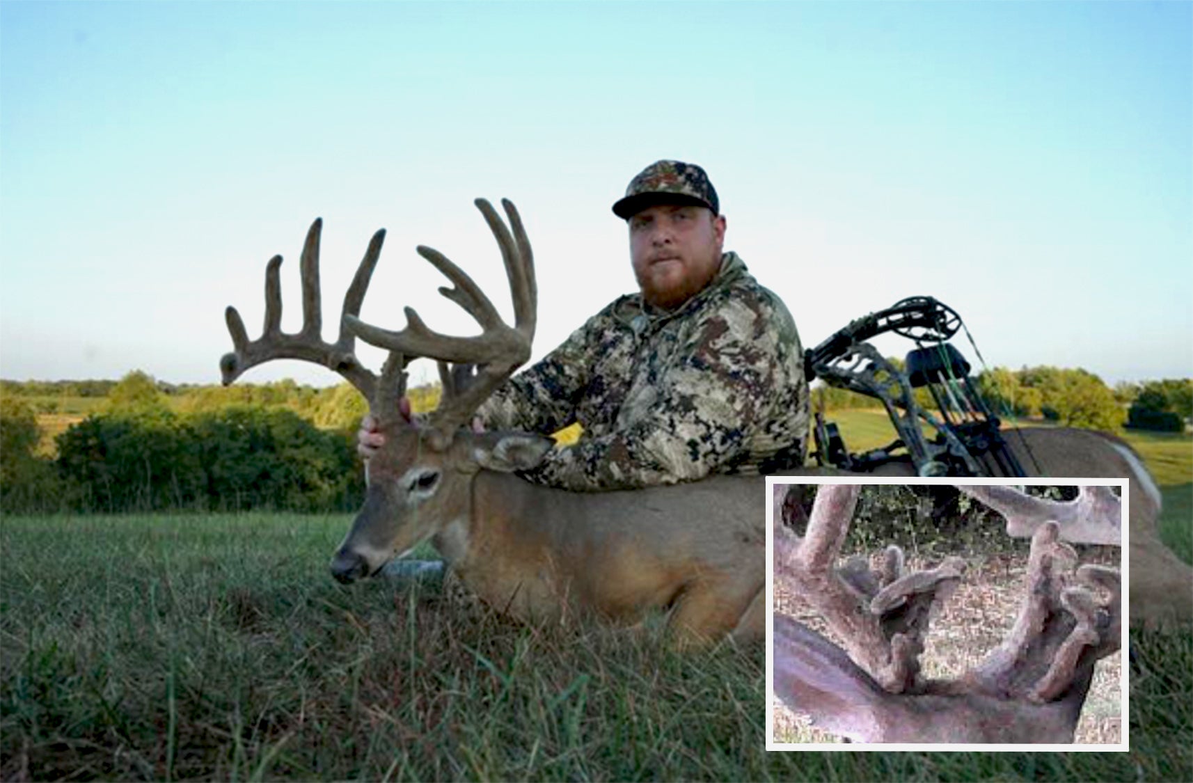 photo of hunter with buck, and inset closeup of buck's antler bases